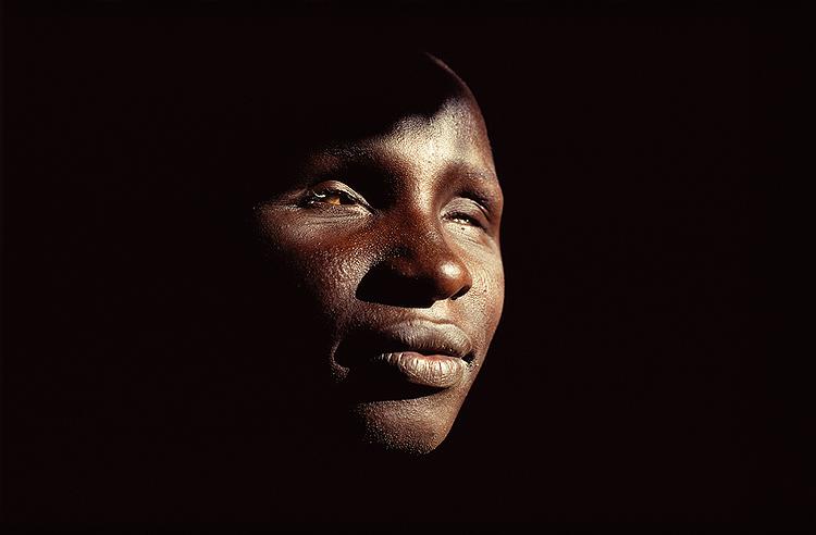 Trachoma Victim, Tanzania, 1991 Archival Pigment Print