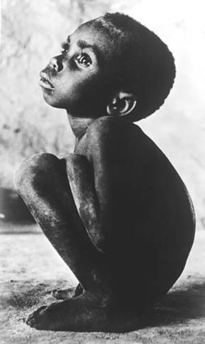 Starvation, Haiti, 1976 Vintage Gelatin Silver Print